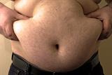 Obesity: NHS Constitution guarantee on access to surgery ignored