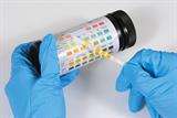 Urine test (Photo: iStock)